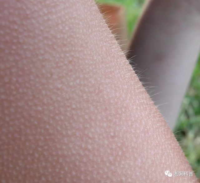 汗毛起竖实际是在排汗但是如果我们贴身穿的衣服是湿的,那就麻烦大了