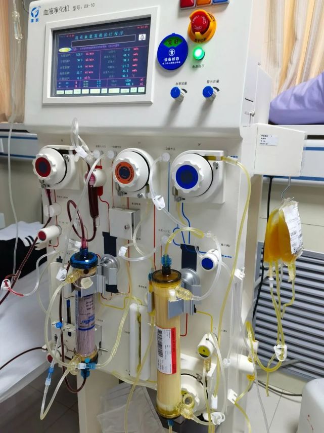 新突破巴州人民医院肾病风湿免疫科成功开展巴州地区首例双重血浆置换