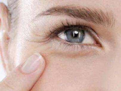 教你如何改善眼周鱼尾纹!