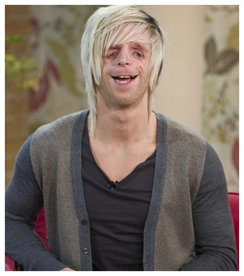 他先天面部畸形凭才华迎娶娇妻婚后孩子刚出生两人面面相觑