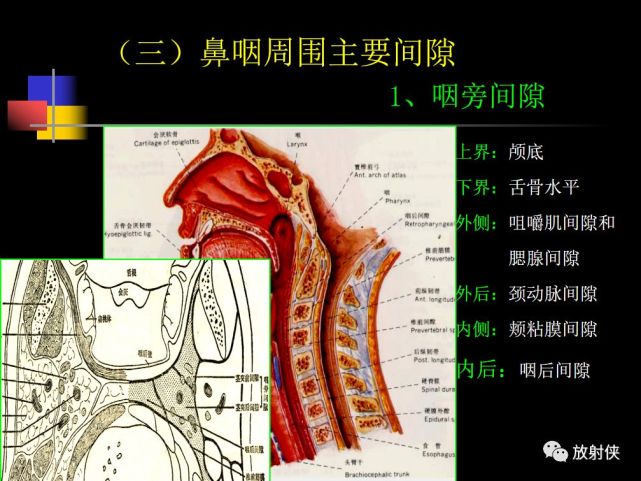 收藏必備|鼻咽部的ct詳細解剖