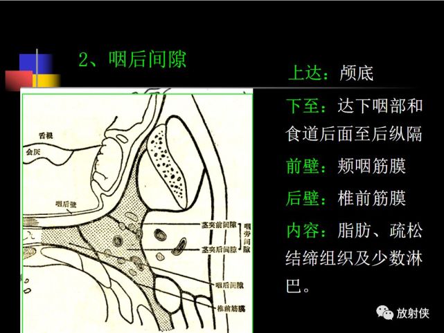 收藏必備|鼻咽部的ct詳細解剖