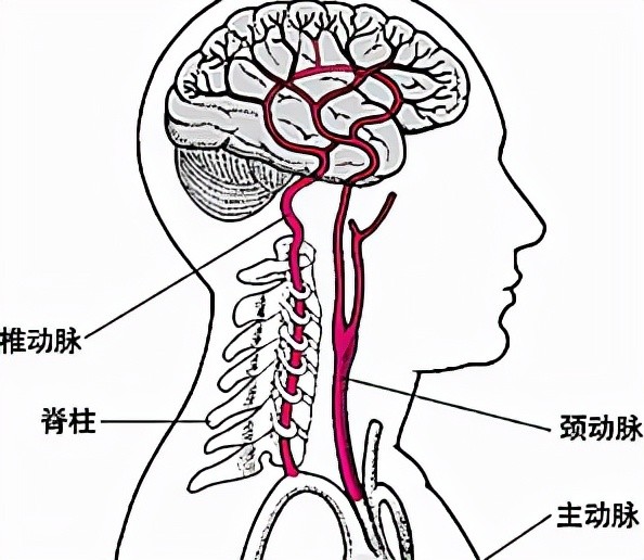 而且还是较为严重的椎动脉型颈椎病,伴有颈部肌肉劳损,颈椎间盘突出的