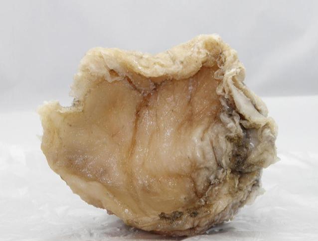 神话里灾难瘟疫的伴生物——长生不老药肉芝