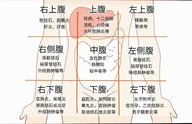 左上腹部隐痛的原因图片