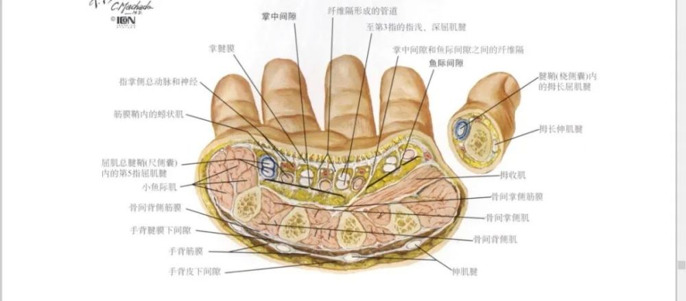 解剖前后位x片手掌上的褶痕韧带连接背侧(比掌侧弱)韧带连接掌侧腕管