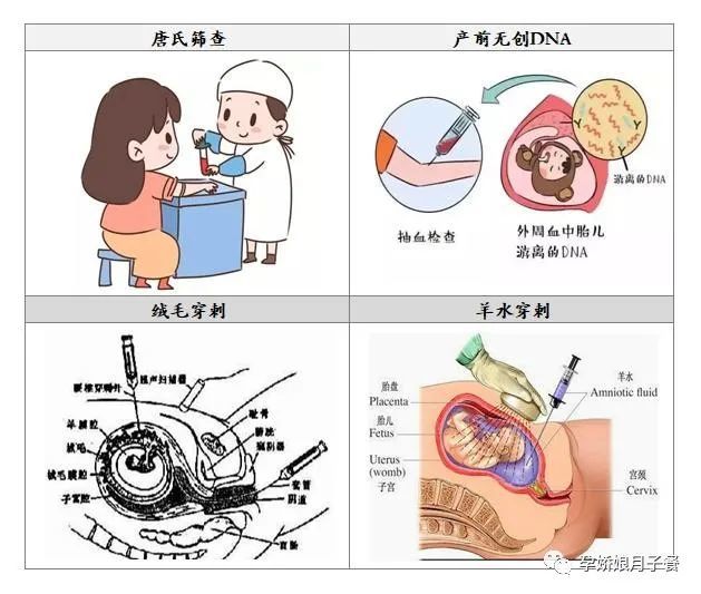 做中唐的時候,提到的開放性神經管缺陷高風險是什麼意思?