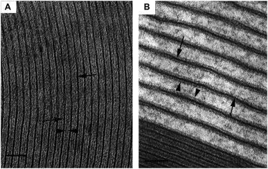 mag学名髓鞘相关糖蛋白(myelin associated glycoprotein),是髓鞘的次