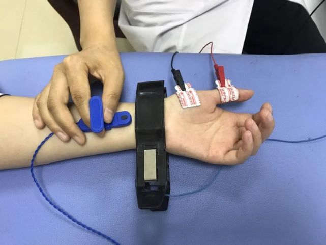 针极肌电图检查出现多汗,少汗,便秘,体位性低血压等自主神经症状可行