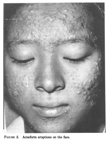 59-1568099因为油症事件,后来日本政府下令禁止使用 dowtherm 作为热