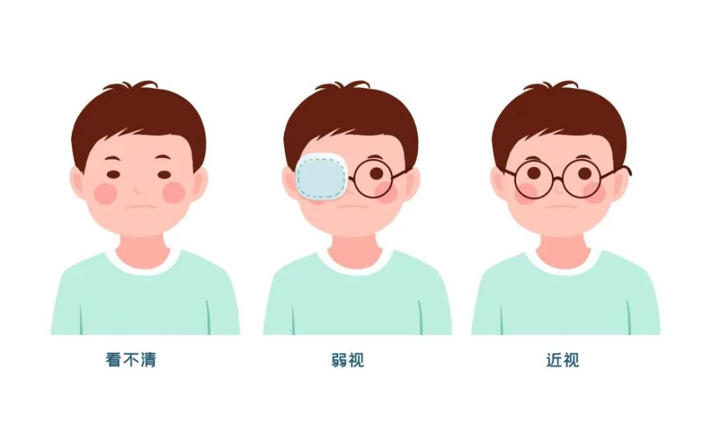 勿错过 黄金 矫正期 儿童弱视 为什么视功能训练必不可少 腾讯新闻