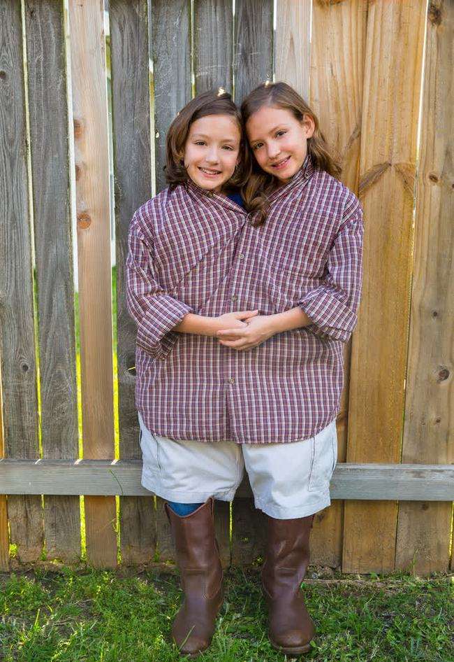 共用一个身体又如何结婚生子?连体人的不幸人生_腾讯新闻