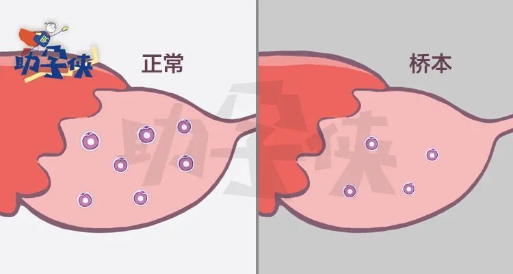 和細胞,卵巢當然也不能倖免,卵子的發育,內膜的容受性都會受到影響