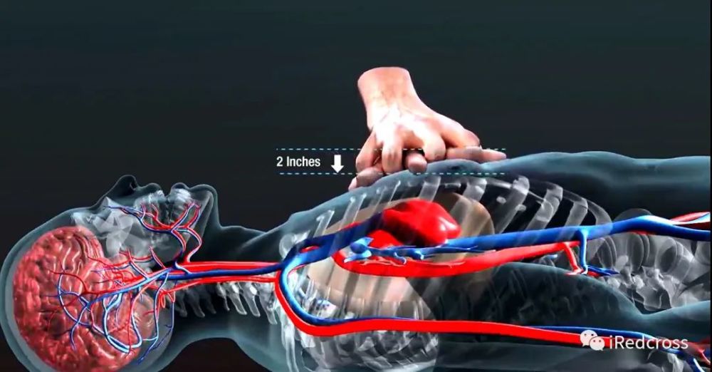 心脏骤停后,脑损伤将在 4 分钟内开始形成,并在 10 分钟后不可逆转.