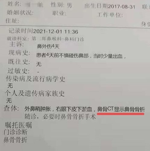 沈阳4岁小孩在早教中心摔成鼻骨骨折 后续赔偿起争议 腾讯新闻