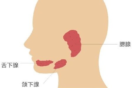 女性腮腺炎是什么症状图片