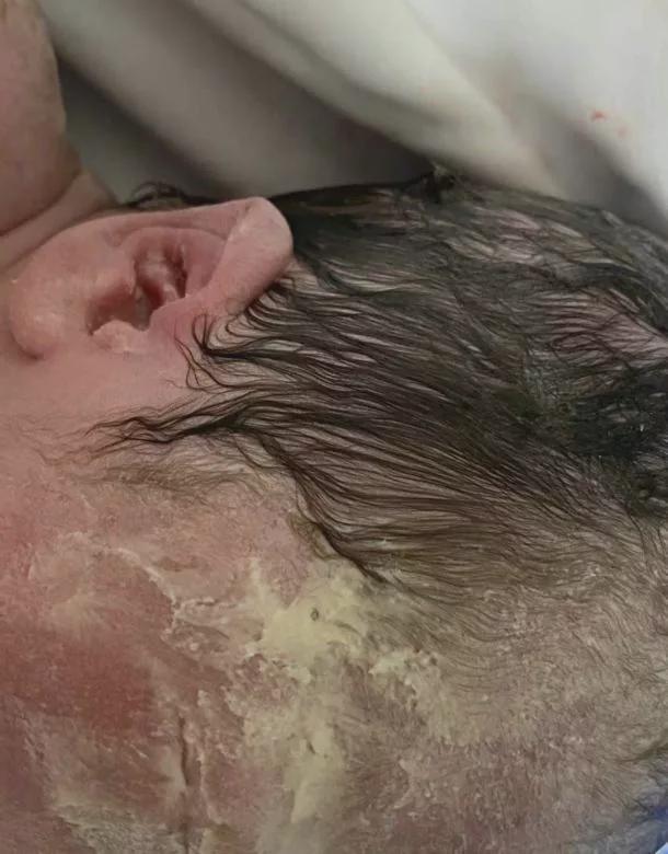 宝妈产下雪娃娃慌了神为啥护士却说没事