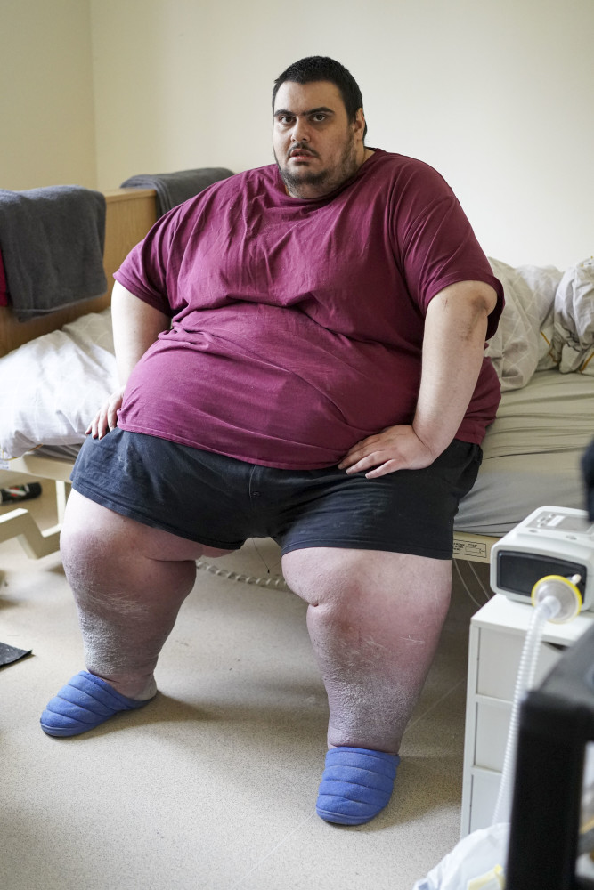 12月19日,据英国《太阳报》报道,英国最肥胖的人杰森·霍尔顿将在圣诞