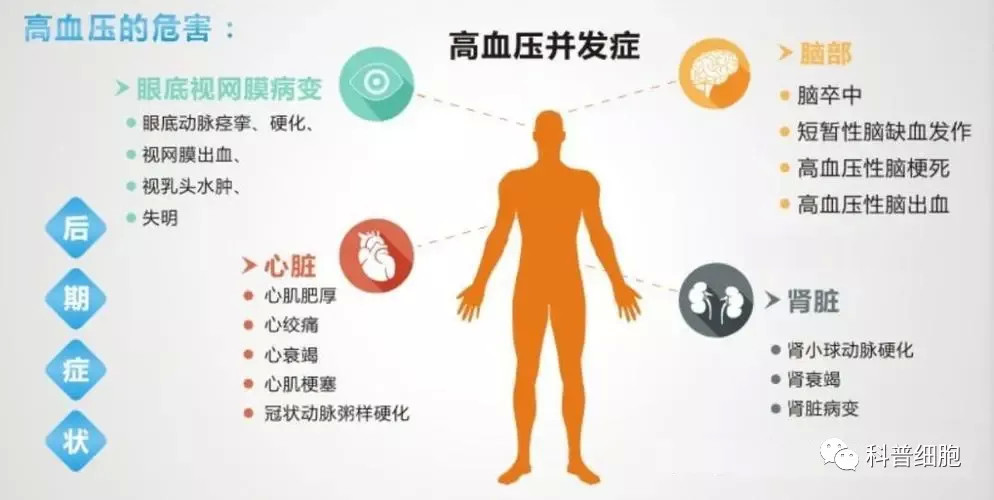 干细胞治疗高血压以及高血压所引起的并发症效果-显著!(附案例!