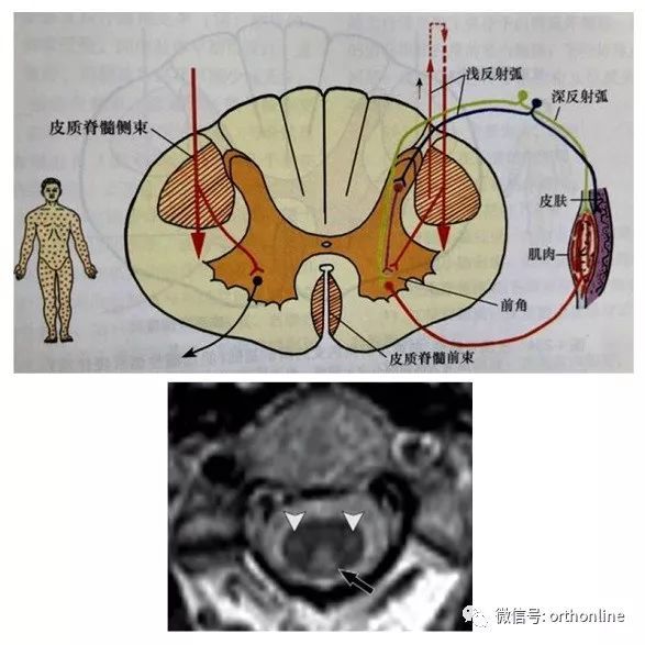 脊髓的解剖和脊髓损伤定位诊断