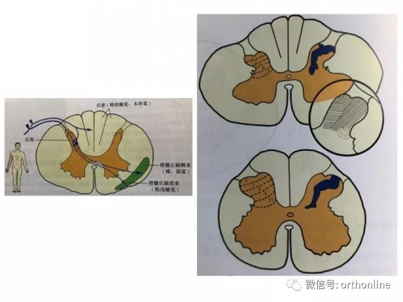 痛,溫覺和部分觸覺與后角神經元形成突觸,而本體覺和部分觸覺直接進入