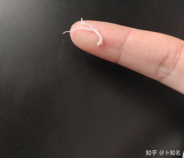 刷牙后或早上起来后嘴里掉皮,这是病了吗?