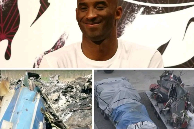 心疼nba科比医学修复图公布胳膊断了腿也没了瓦妮莎签字