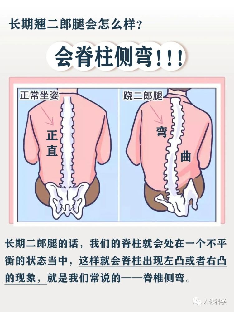 錯誤姿態長期蹺二郎腿的人到底會怎麼樣