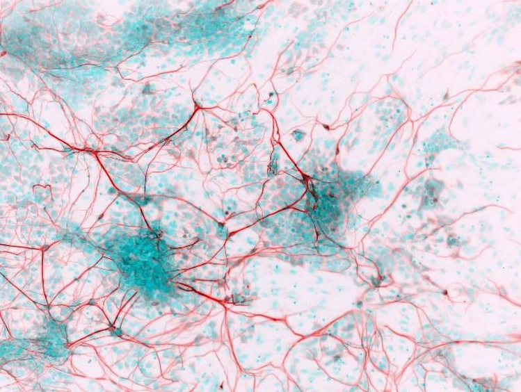 干细胞衍生的神经元,显微艺术版画而后者不仅能分泌核心功能因子