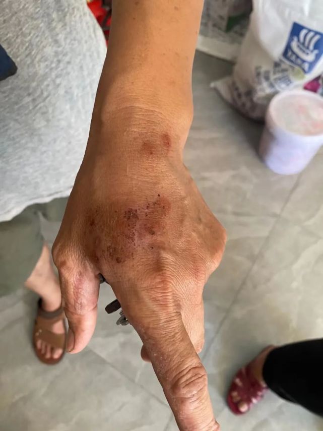 注意到,"乡下农田,城市绿地,怎么到处都是烂牛屎包一样恶心的蚂蚁窝?