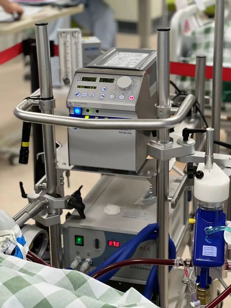 【延伸服务】救命神器ecmo接力救治 危在旦夕小伙转危为安_腾讯新闻