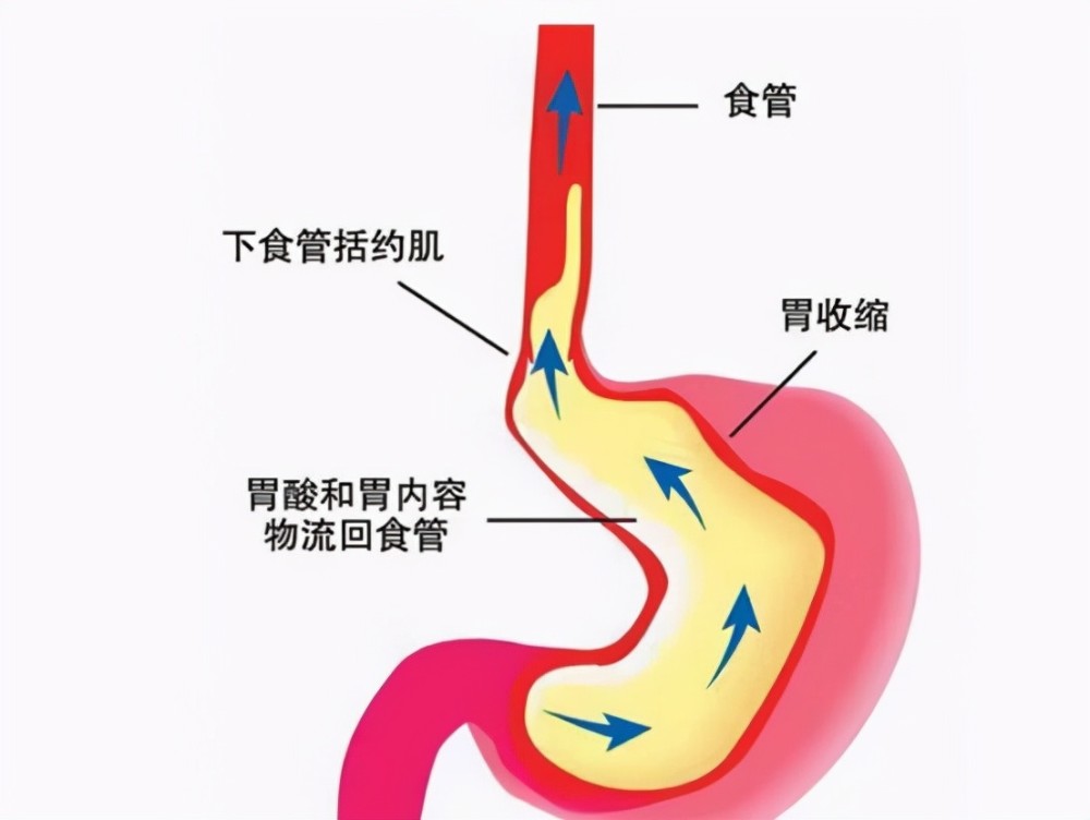 远离食管道疾病从饮食上该如何预防