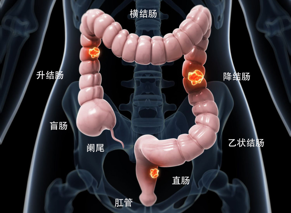 肠腔在什么位置图片图片