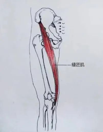 缝匠肌3生活中发于常在斜坡行走,蜷曲身体睡觉,屈曲关节久坐的人群
