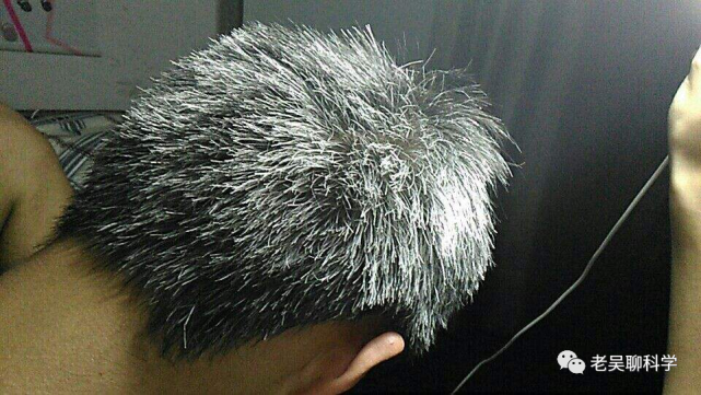 白头发越拔越多,黑芝麻真的能乌发?央视告诉你真相