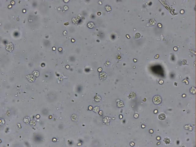 伪装者人芽囊原虫