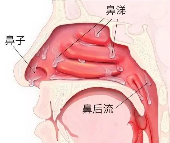 宝宝哭喉咙呼呼的有痰不敢用药怎么办