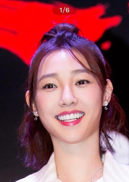 明星烤瓷牙大pk,有人嘴包不住牙,有人丑哭了,有人300万打水漂