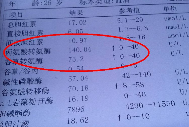 如果本身有肝病,转氨酶指标高于80,也不用太紧张,一般转氨酶在40-80