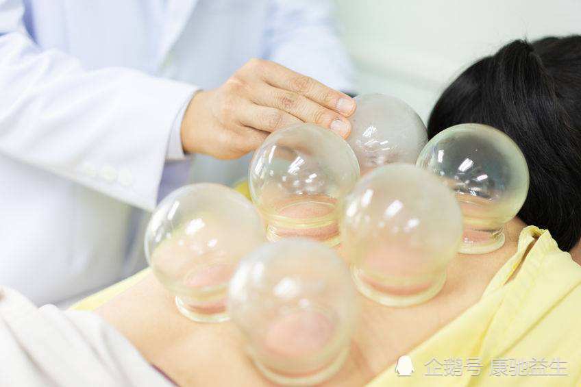 孕妇能拔罐吗 腾讯网