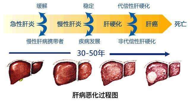 肝病種類有哪些