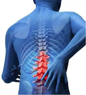医学上闪腰被称为急性腰扭伤,多由姿势不当,用力过猛,超限活动以及