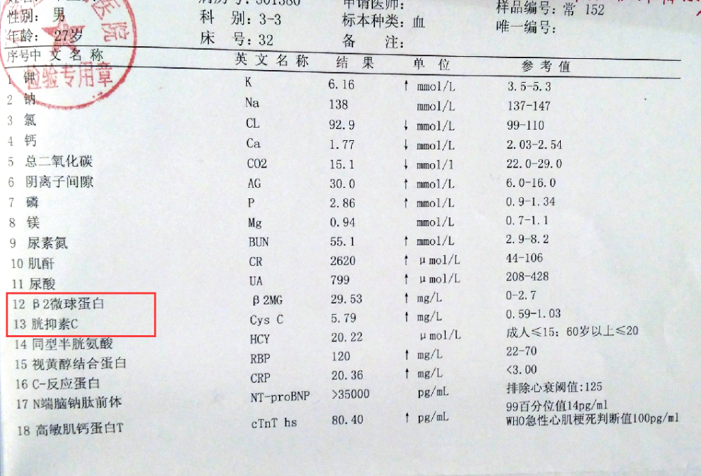 還是看這張化驗單,這兩個指標更精準:但是,最常檢查的腎功能三項,卻很