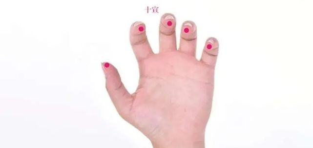 中医放血通常只在十个指尖放血,每个指头挤出一两滴,效果就出来了.