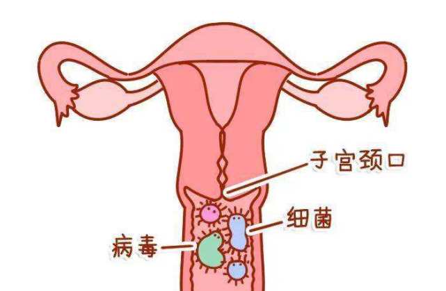 貝安健康宮頸糜爛分為哪三種程度