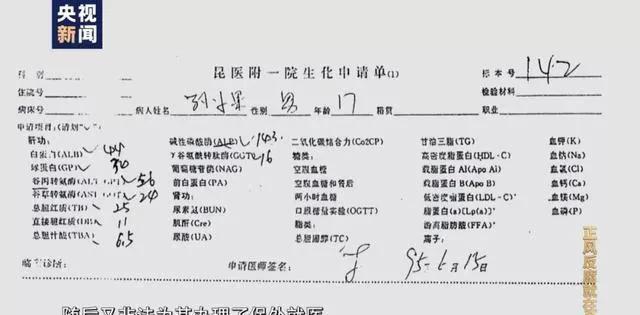 酒精过敏的住院回执单照片 腾讯网