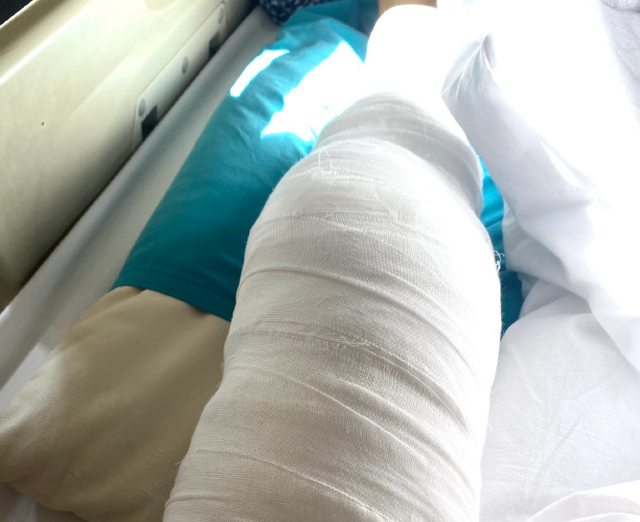 "从照片来看,王辰玥完成的应该是左膝手术.