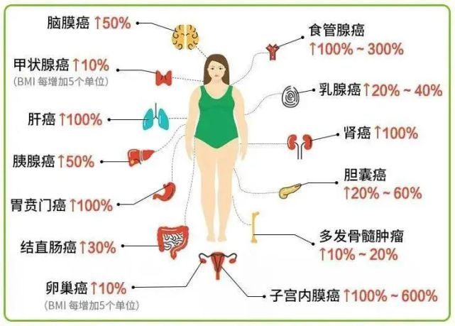 此外,包括乳腺癌,肝癌,胰腺癌等13 种癌症都"偏爱"肥胖人群,目前已经
