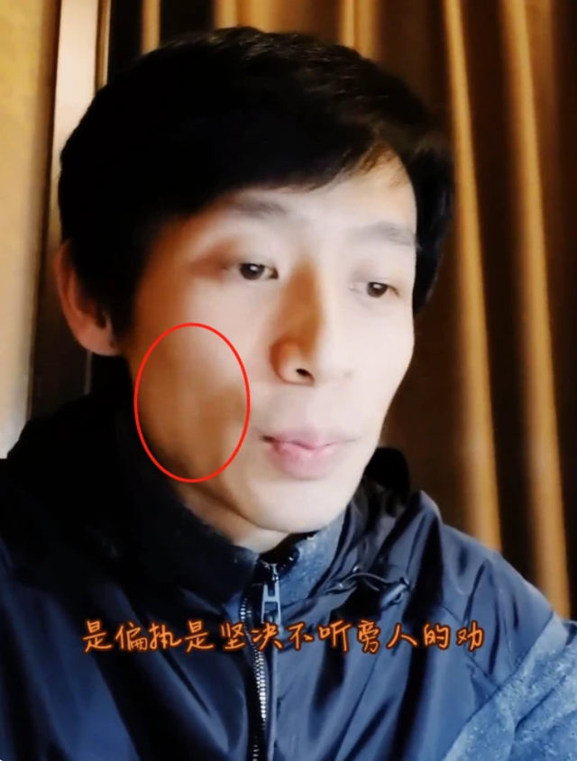 魏晨婚后首次亮相一脸病态脸颊凹陷已瘦到脱相魏晨很健康