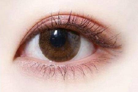 双眼皮科普｜每个人都适合7mm的双眼皮宽度吗？
